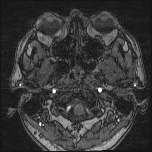 Click on the Serie image to view the images of VILLANUEVA, WILLIAM A.